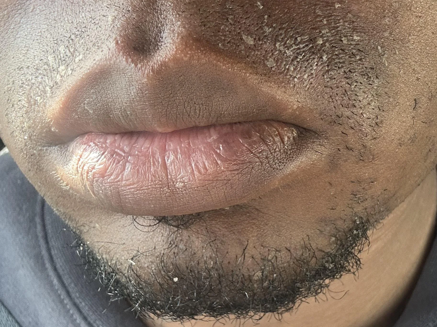 Our skin is drier and we don't grow beards as easily