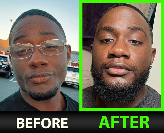 Marcus T before and after