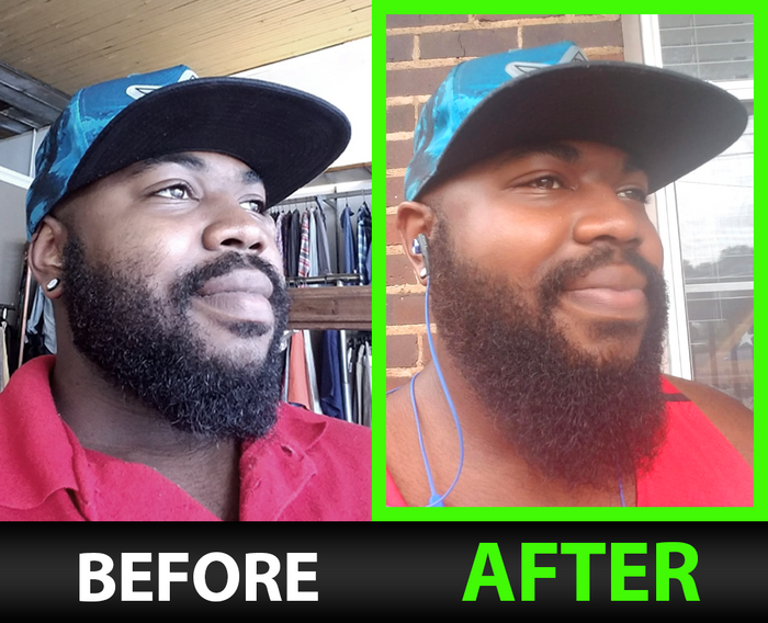 Leon A. before and after
