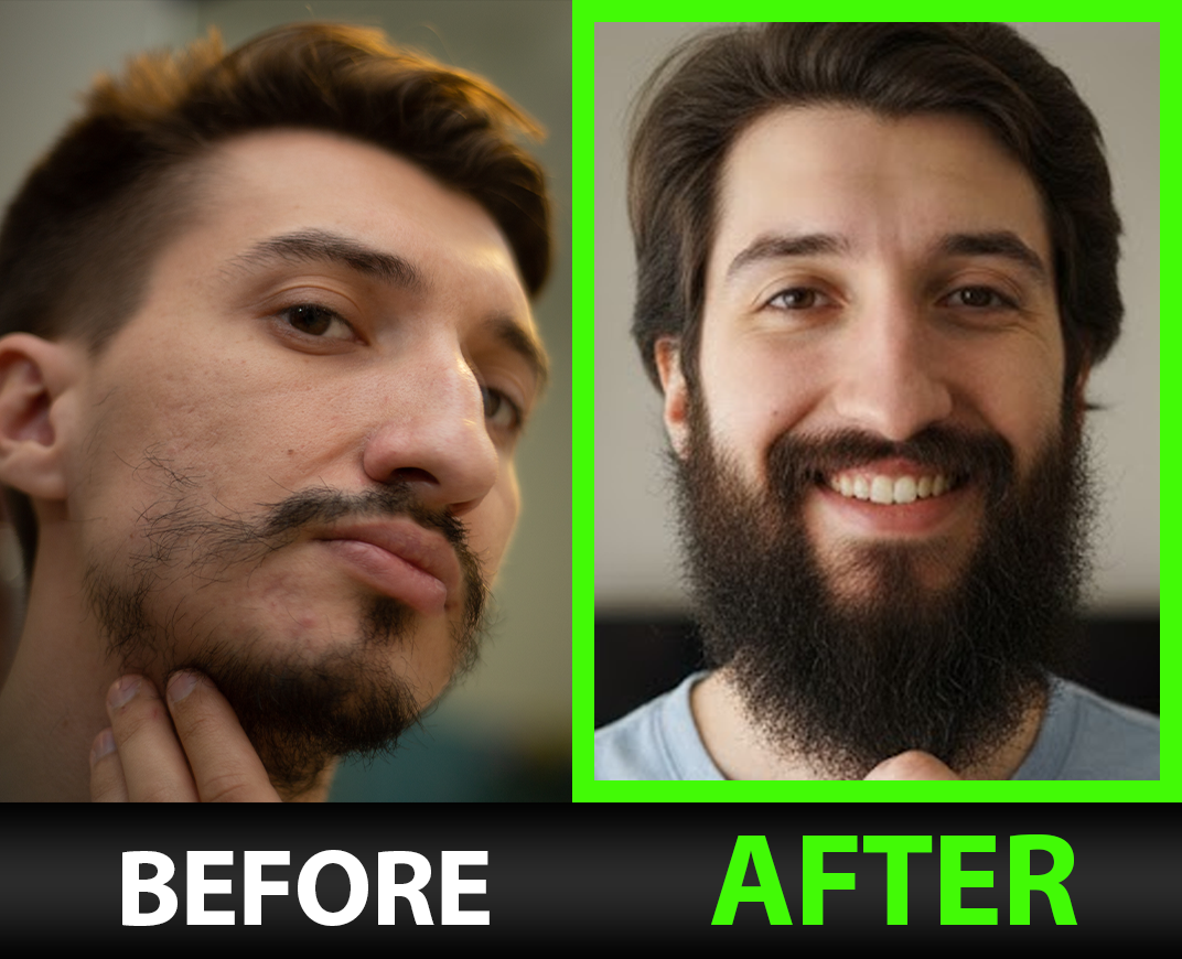 BBS Beard Growth Serum with Minoxidil, 2X Biotin, Rice Water, and LCLT