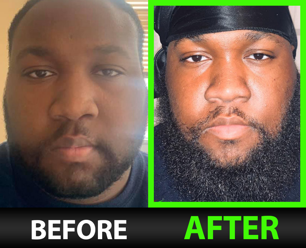 Before and after results
