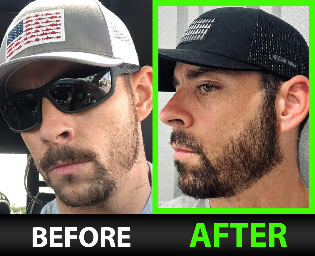 Before and after — Arthur W.