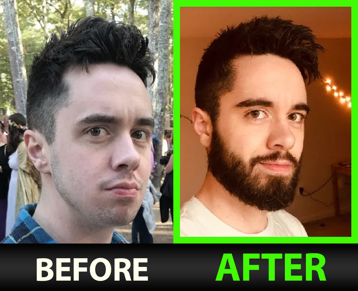 Michael P before and after
