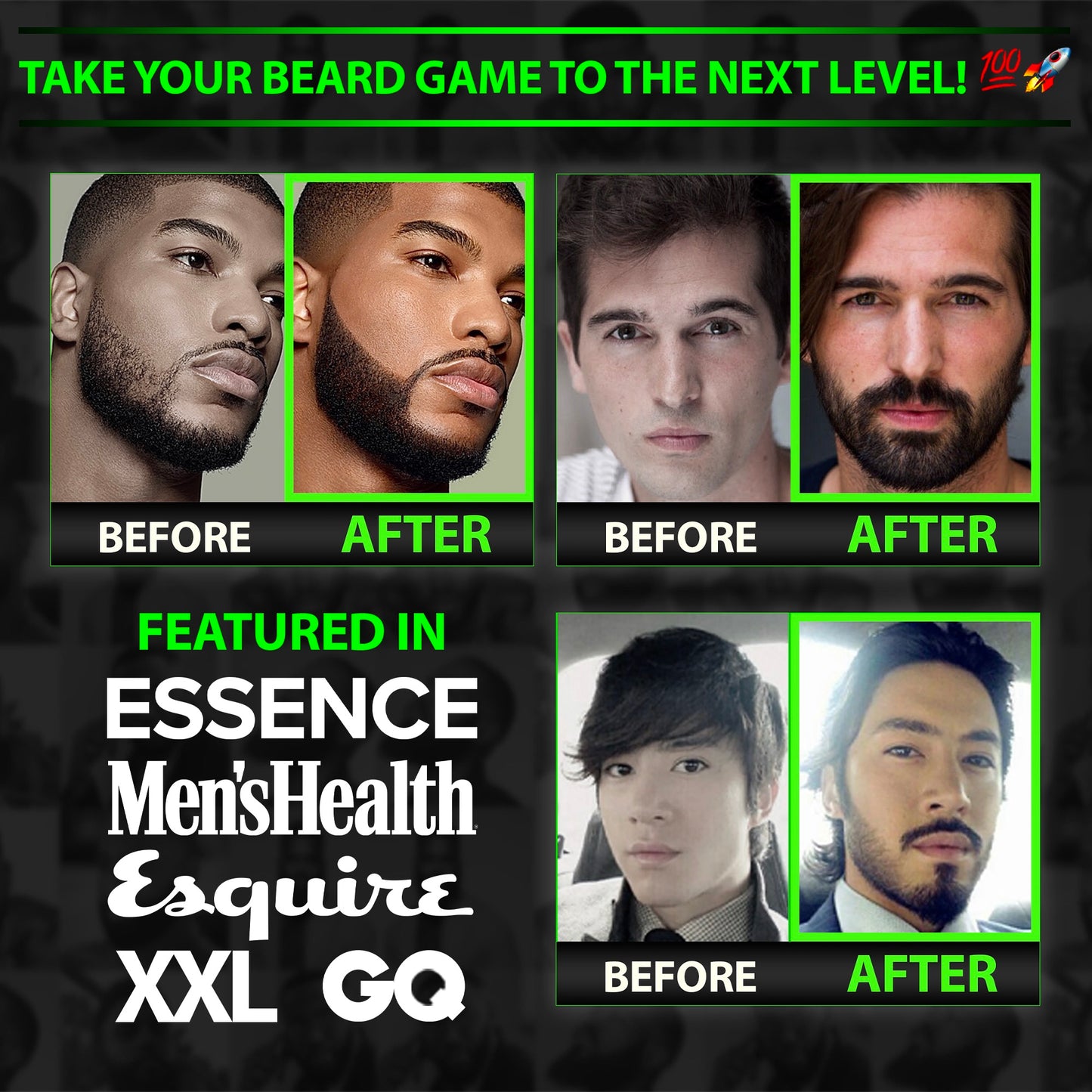 GROW® Beard Roller Kit