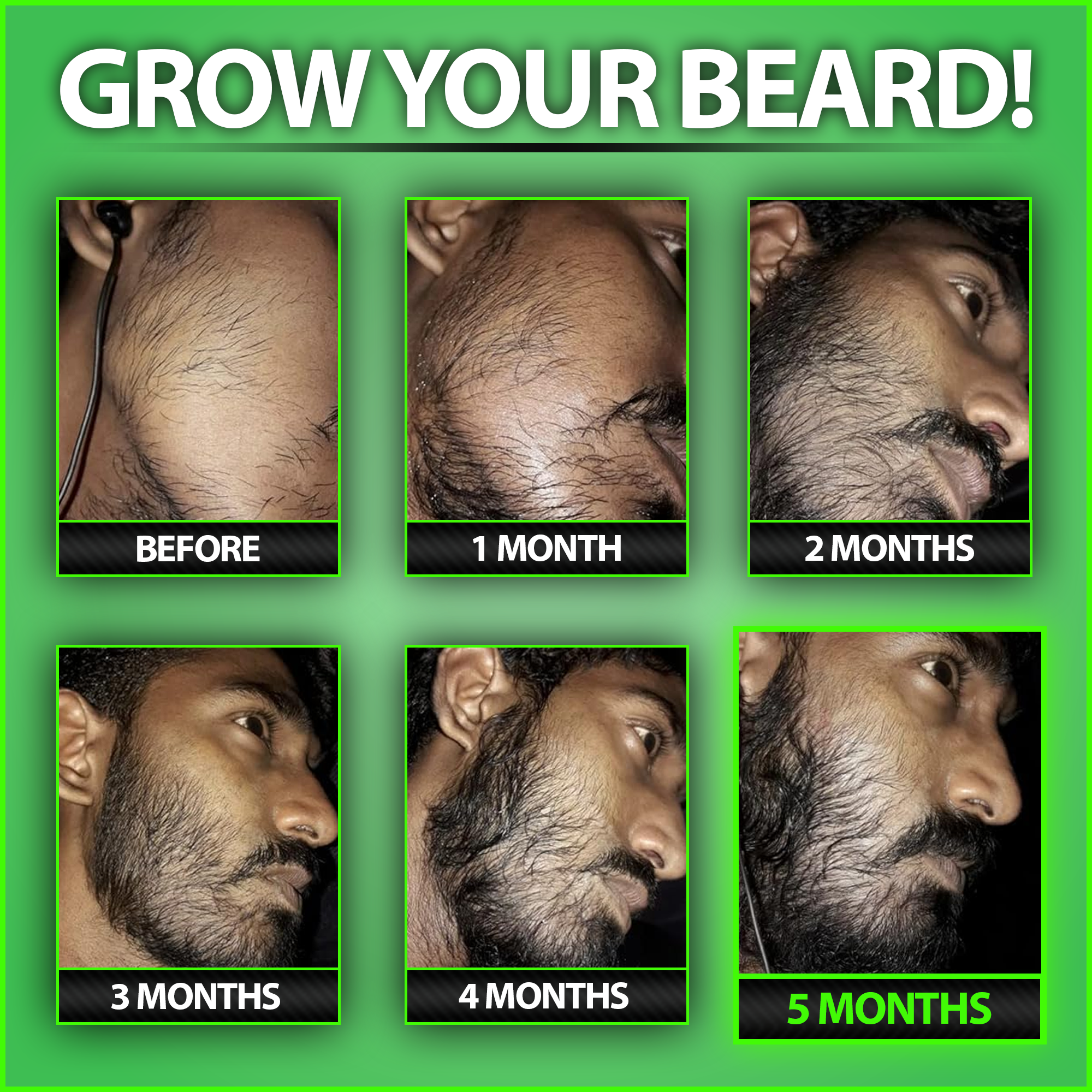 GROW EPIC!!! 3-Pack of GROW® XXL Beard Growth Accelerator